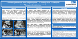 Thumbnail for Complete hydatidiform molar pregnancy with a coexisting fetus: A case report