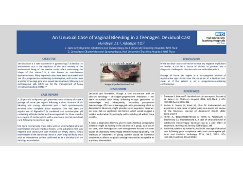 Preview of An Unusual Case of Vaginal Bleeding in a Teenager: Decidual Cast