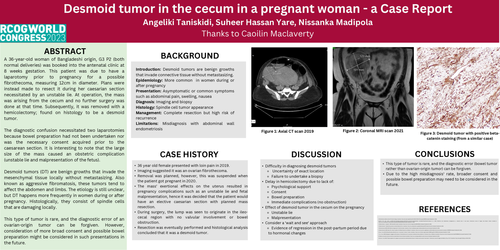 Preview of Desmoid tumor in the cecum in a pregnant woman