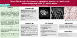 Thumbnail for Desmoid tumor in the cecum in a pregnant woman