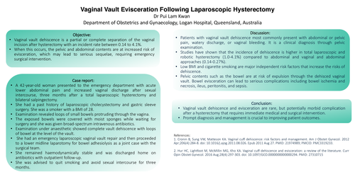 Preview of Vaginal vault evisceration following laparoscopic hysterectomy