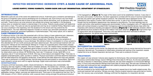 Preview of Infected Mesenteric Dermoid Cyst: A Rare Cause of Abdominal Pain.