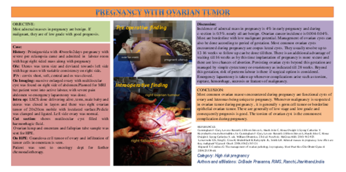 Preview of Pregnancy with ovarian tumor