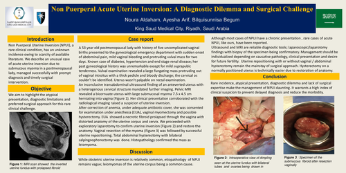 Preview of Non Puerperal Acute Uterine Inversion : A Diagnostic Dilemma and Surgical Challenge