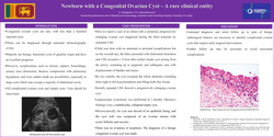 Thumbnail for Newborn with a congenital ovarian cyst – A rare clinical entity