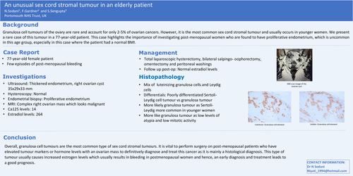Preview of An unusual sex cord stromal tumour in an elderly patient