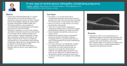 Thumbnail for A rare case of central serous retinopathy complicating pregnancy