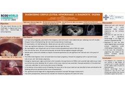 Thumbnail for DIAGNOSING CORPUS LUTEAL HEMORRHAGE: A DIAGNOSTIC DILEMMA