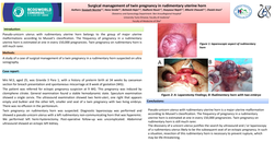 Thumbnail for Surgical management of twin pregnancy in rudimentary uterine horn