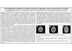Thumbnail for POSTERIOR REVERSIBLE ENCEPHALOPATHY SYNDROME ASSOCIATED WITH ECLAMPSIA