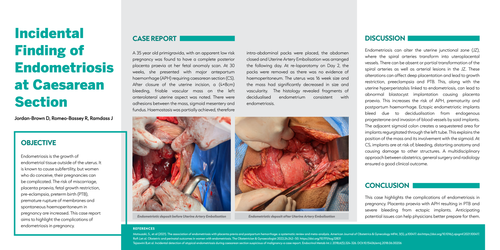 Preview of Incidental Finding of Endometriosis at Caesarean Section