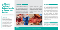 Thumbnail for Incidental Finding of Endometriosis at Caesarean Section