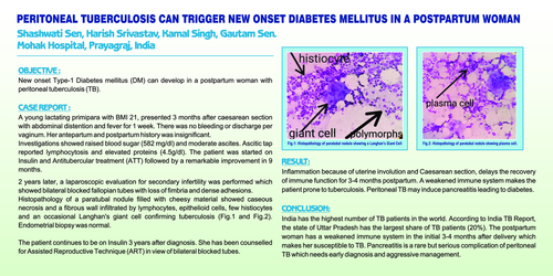 Preview of PERITONEAL TUBERCULOSIS CAN TRIGGER NEW ONSET DIABETES MELLITUS IN A POSTPARTUM WOMAN