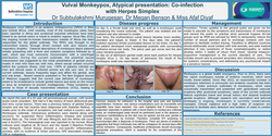Thumbnail for Co-infection of Monkeypox with Herpes simplex infection