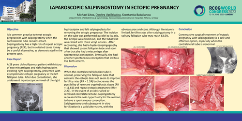 Preview of LAPAROSCOPIC SALPINGOSTOMY IN ECTOPIC PREGNANCY