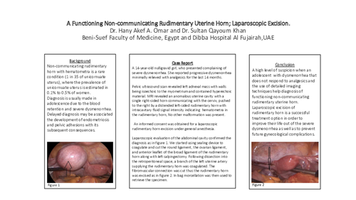 Preview of Case report: A Functioning Non-communicating Rudimentary Uterine Horn; Laparoscopic Excision.