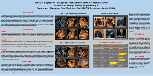 Preview of Prenatal diagnosis of Tetralogy of Fallot and its variants- Case series analysis