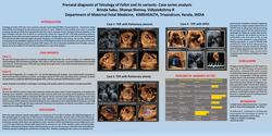 Thumbnail for Prenatal diagnosis of Tetralogy of Fallot and its variants- Case series analysis
