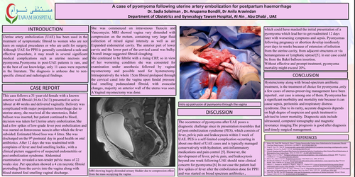 Preview of A case of pyomyoma following uterine artery embolization for postpartum hemorrhage