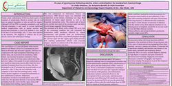 Thumbnail for A case of pyomyoma following uterine artery embolization for postpartum hemorrhage