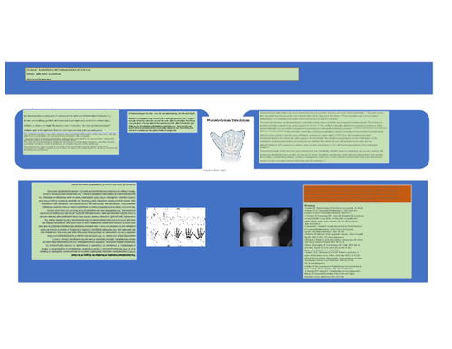 Preview of Female baby born with moderate symberachydactyly in PG at 38weeks
