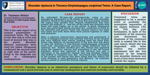 Preview of “Shoulder dystocia in Thoraco-Omphalopagus conjoined Twins: A Case Report.’’