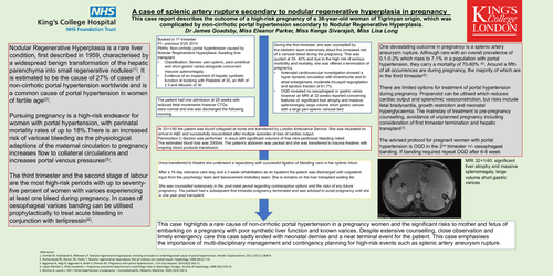 Preview of A case of splenic artery rupture secondary to nodular regenerative hyperplasia