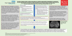 Thumbnail for A case of splenic artery rupture secondary to nodular regenerative hyperplasia