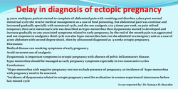 Thumbnail for Delay diagnosis of ectopic pregnancy