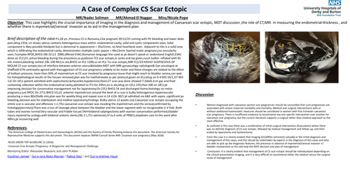 Preview of Complex case of caesarean scar ectopic pregnancy