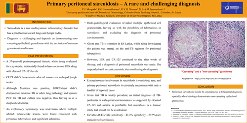 Preview of Primary peritoneal sarcoidosis – A rare and challenging diagnosis