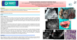 Thumbnail for Uncommon presentations of gestational trophoblastic disease