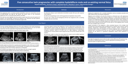 Thumbnail for Five consecutive twin pregnancies with co-existing complete hydatidiform mole and normal fetus