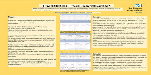 Preview of FETAL BRADYCARDIA – Hypoxia Or congenital Heart Block(CHB)?