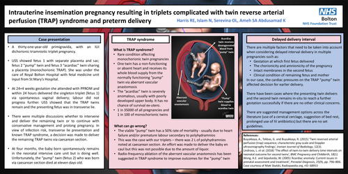 Preview of Intrauterine insemination pregnancy resulting in triplets complicated with TRAP syndrome