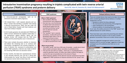 Thumbnail for Intrauterine insemination pregnancy resulting in triplets complicated with TRAP syndrome