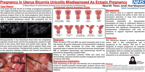 Preview of Pregnancy in Uterus bicornis unicollis misdiagnosed as an ectopic pregnancy.
