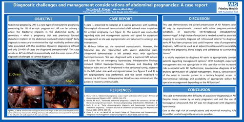 Preview of Diagnostic challenges and management considerations of abdominal pregnancies: A case report
