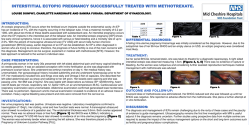 Preview of Cornual Ectopic Pregnancy Successfully Treated with Methotrexate.