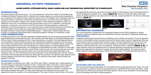 Preview of Abdominal Ectopic Pregnancy.