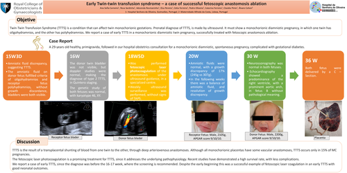 Preview of Early Twin-twin transfusion syndrome – a case of successful fetoscopic anastomosis ablation