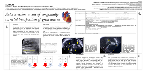 Preview of Autocorrection: a case of congenitally corrected transposition of great arteries