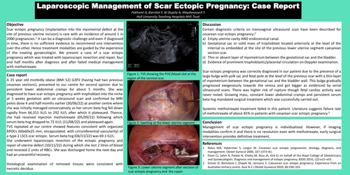 Preview of Laparoscopic Management of Scar Ectopic Pregnancy: Case Report