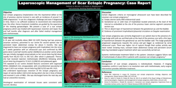 Thumbnail for Laparoscopic Management of Scar Ectopic Pregnancy: Case Report