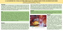 Thumbnail for TUBAL ECTOPIC PREGNANCY IN A HEMI-UTERUS WITH A RUDIMENTARY HORN:CASE REPORT