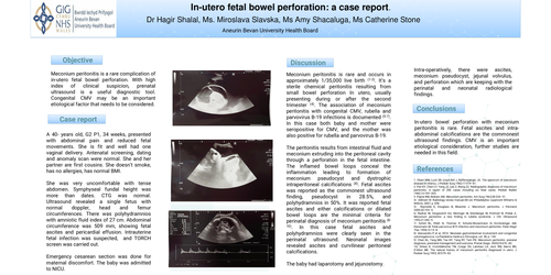 Preview of In-utero fetal bowel perforation: a case report.