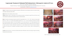 Thumbnail for Laparoscopic Treatment of Abdominal Wall Endometriosis: A Retrospective Analysis of 8 Cases