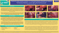 Thumbnail for Ruptured corpus luteum causing 1.2 L haemoperitoneum alongside an ongoing intrauterine pregnancy