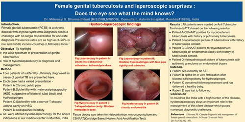 Preview of Laparoscopy in Genital Tuberculosis - Does the eye see what the mind knows?