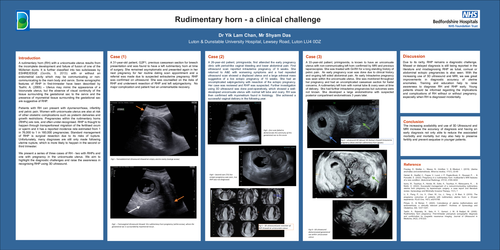 Preview of Rudimentary horn - a clinical challenge